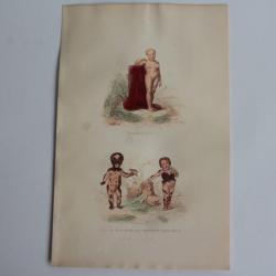 Gravure BUFFON Petite fille couverte de taches velues  XIXe si&egrave;cle