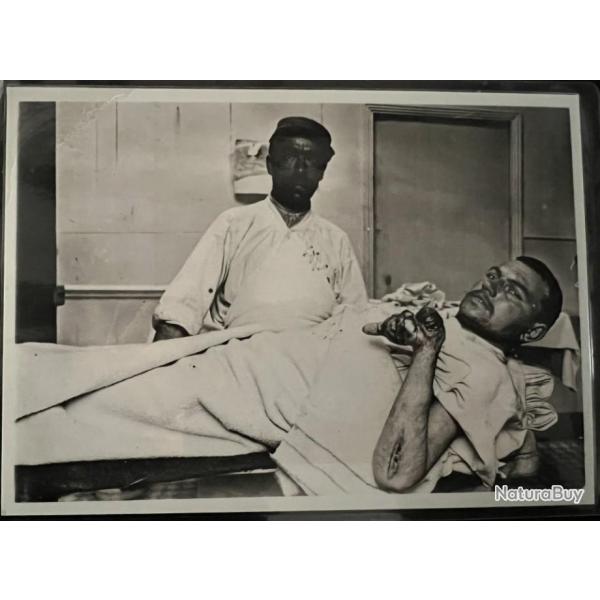 Photo d'un mdecin Franais de 14-18 avec un bless touch au bras et  la main