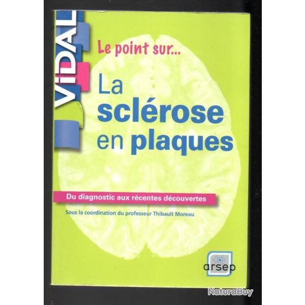 le point sur....la sclrose en plaques du diagnostique aux rcentes dcouvertes thibault moreau