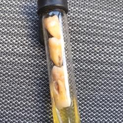 Ancienne dents molaires sous formol objets de curiosit&eacute;s
